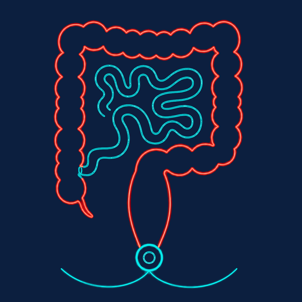 Ulcerative colitis affecting the entire colon and rectum, before any surgery